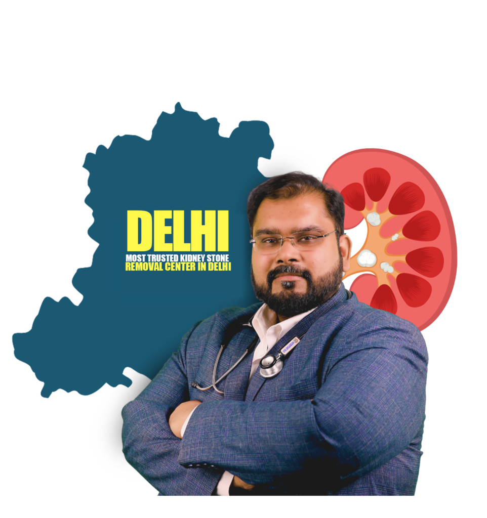 Kidney Stone Laser Removal in Delhi