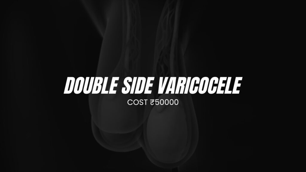 Double Side Varicocele surgery cost
